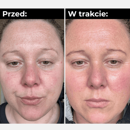 RevitaEyes™ Pro