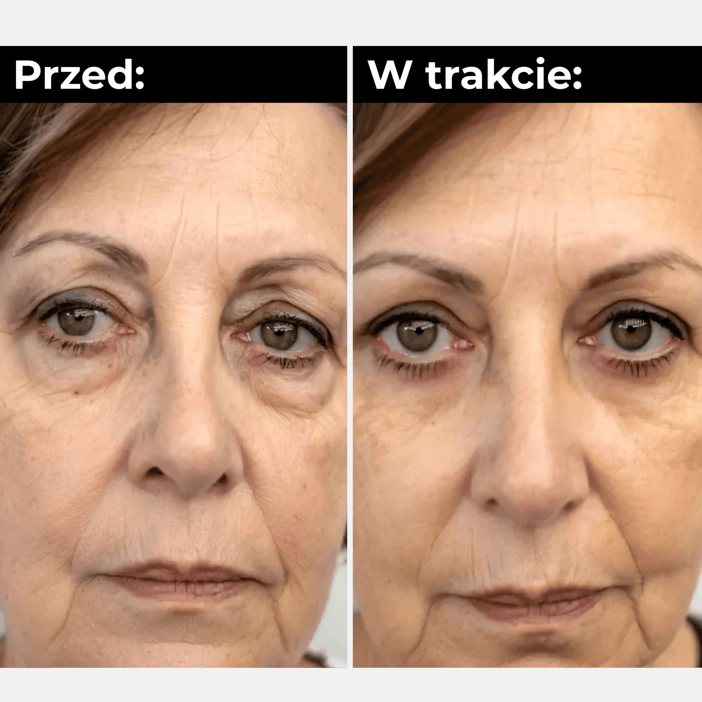 RevitaEyes™ Pro