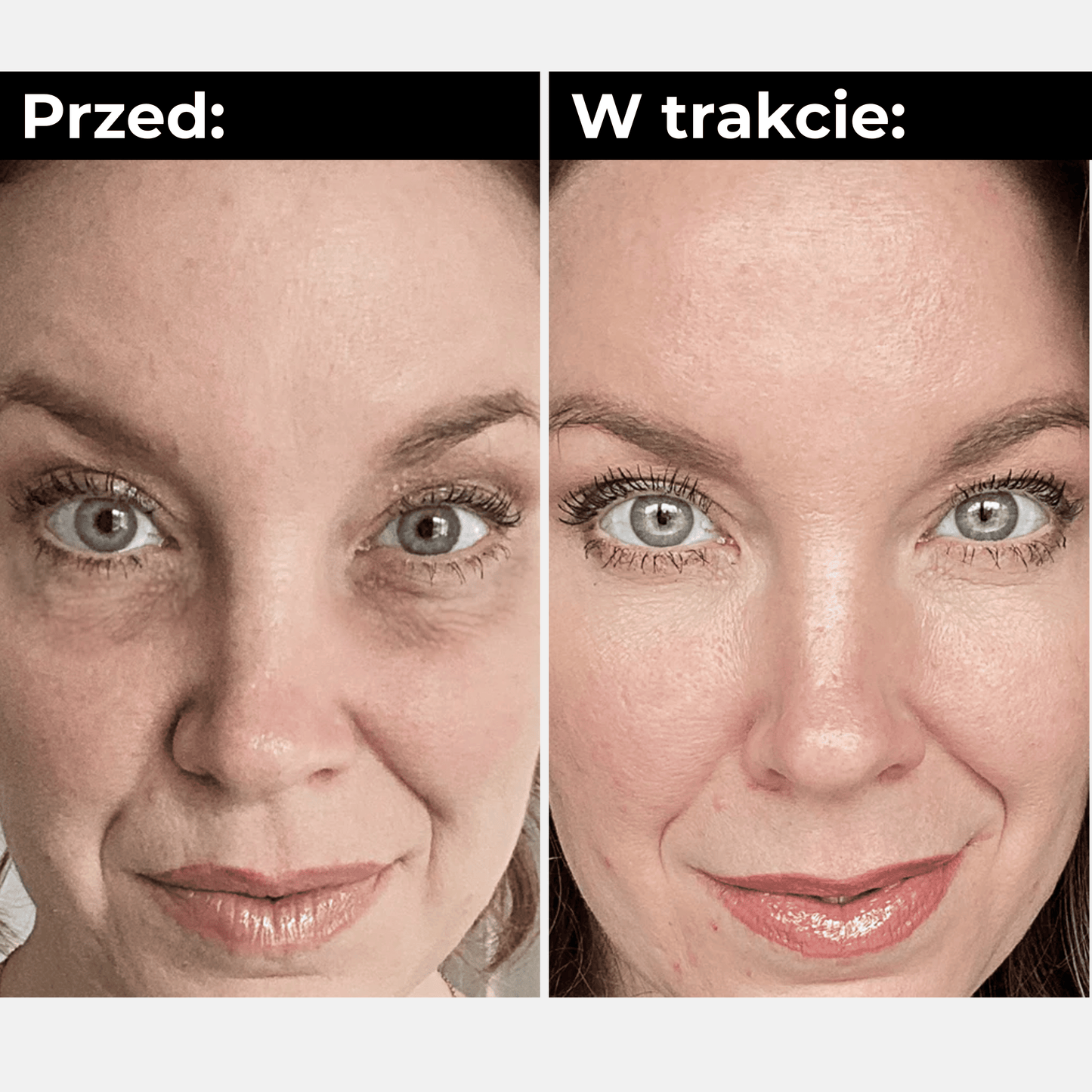 RevitaEyes™ Pro