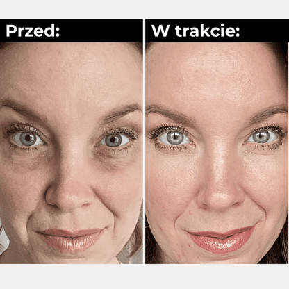 RevitaEyes™ Pro