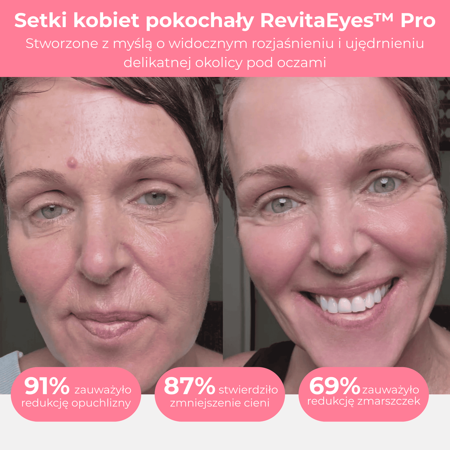 RevitaEyes™ Pro