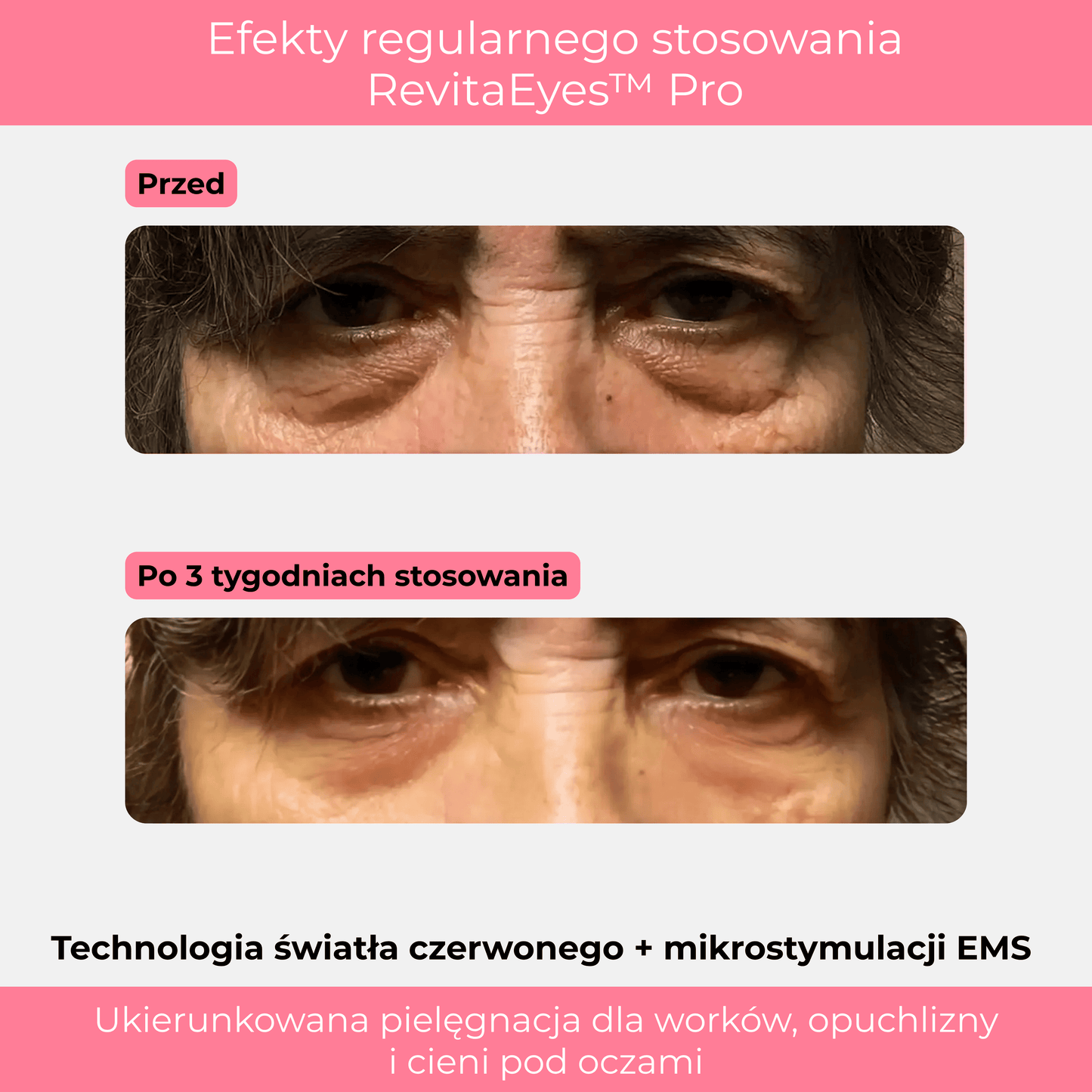 RevitaEyes™ Pro