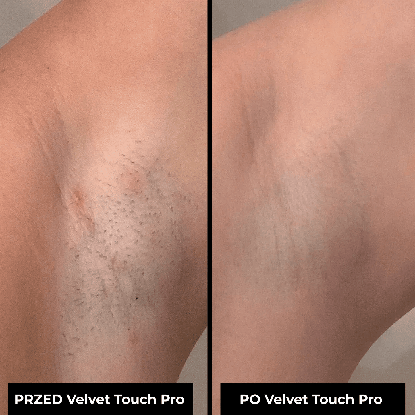 Velvet Touch Pro
