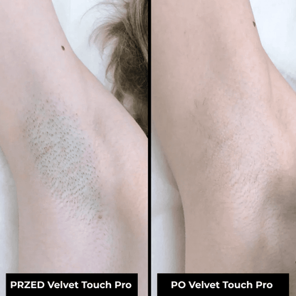 Velvet Touch Pro