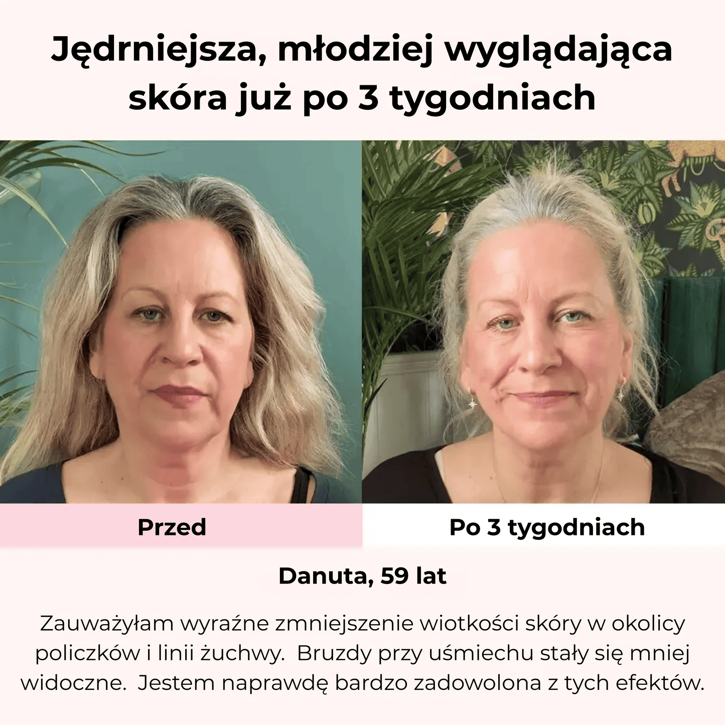 SkinGlow™ LED Mask