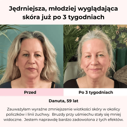 SkinGlow™ LED Mask