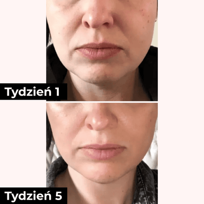 SkinGlow™ LED Mask